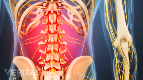 Lower back pain