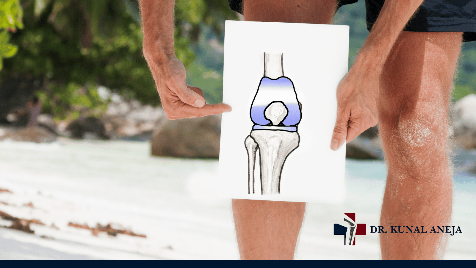 Knee Replacement in Delhi | Surgery Details & Recovery