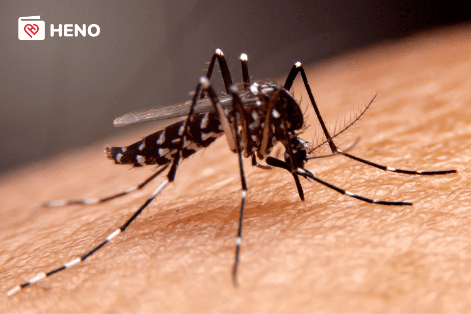 muỗi vằn là tác nhân gây các triệu chứng sốt xuất huyết ở người lớn