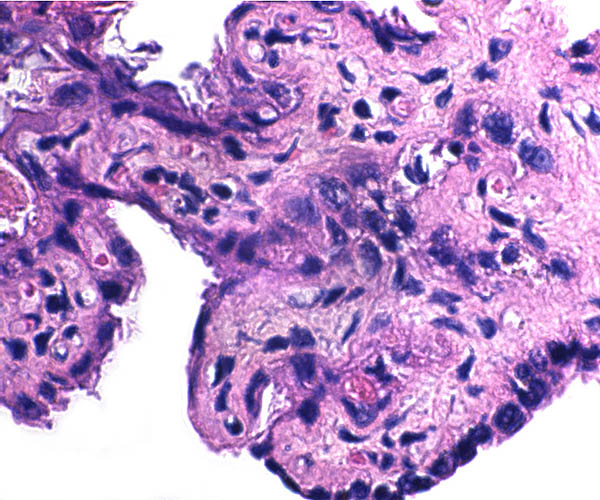 Final arborization of a villus with single-layer trophoblast