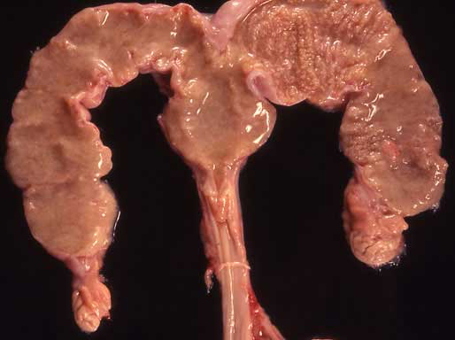 Uterus from a bitch with protestin induced cystic endothelial hyperplasia and pyometra