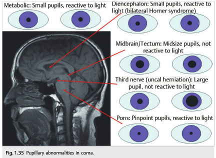 Neuro-ophthalmology Illustrated Chapter 1 – Examination 6 — Neuro