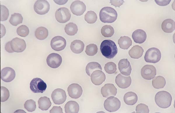 Canine blood. PK deficiency...