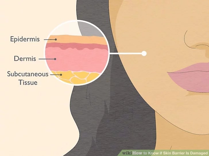 Black Skin: 8 Damaged Skin Barrier Signs