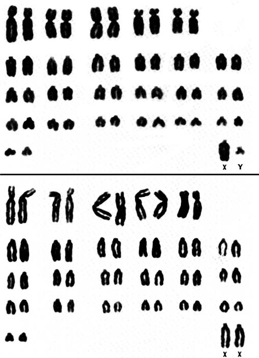 Male and female chromosome sets