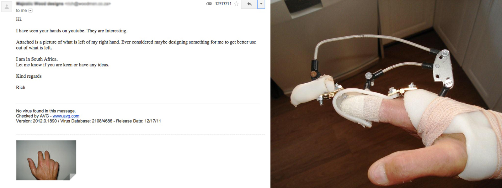 Original email sent to Ivan from Richard asking for help to create a prosthetic finger.