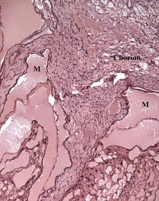 Chorionic surface with maternal sinuses (M).