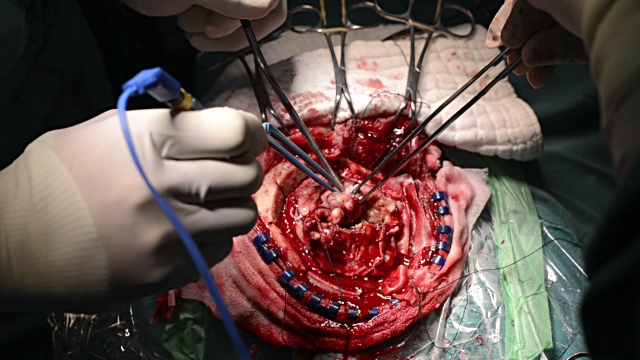 Image result for neurosurgeon