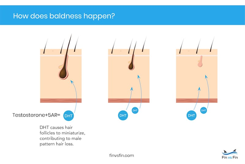 does finasteride increase free testosterone