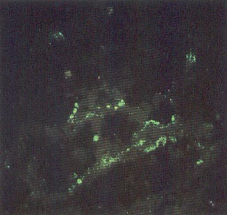 Inmunofluorescencia de parvovirus canino 2 en secciones congeladas de intestino canino. Cortesía de A. Wayne Roberts.