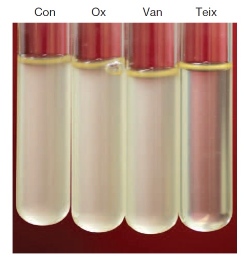 Resultado de la teixobactina y otros antibióticos frente a S. aureus. Con: control. Ox: oxalacilina. Van: vancomicina. Teix: teixobactina. Fuente: Nature