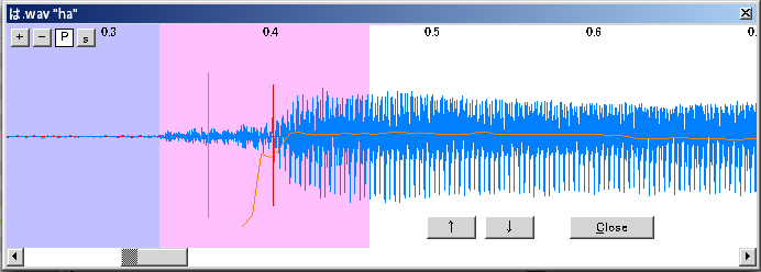 kjEOAhJBUueZDn5eXKzFFrnkLizdS5dBBushjM9kglQsED-pQtVsr_i-kxvwD74M3UF9KiW34DKtNraFWuAQcS8TIEqGw6BVzmA40mSJDYepgt8ITPZgXzcngLTB90z5ukJSTPg