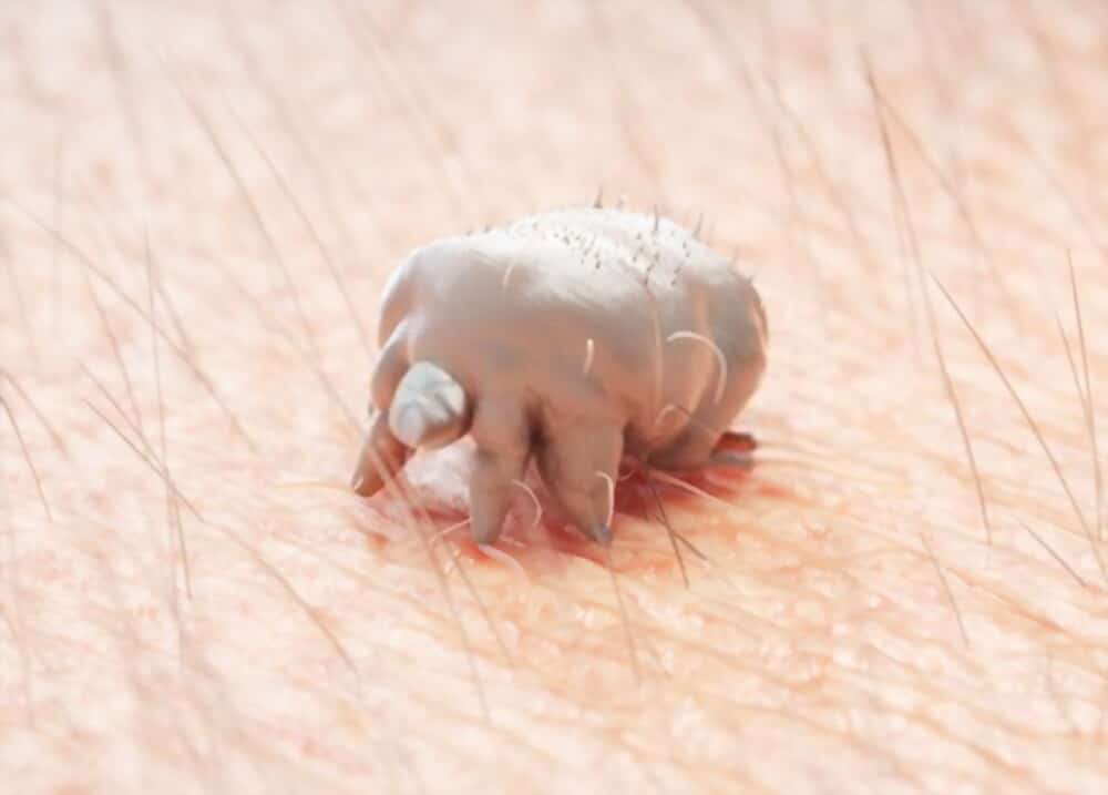 Human itch mites bite on vag