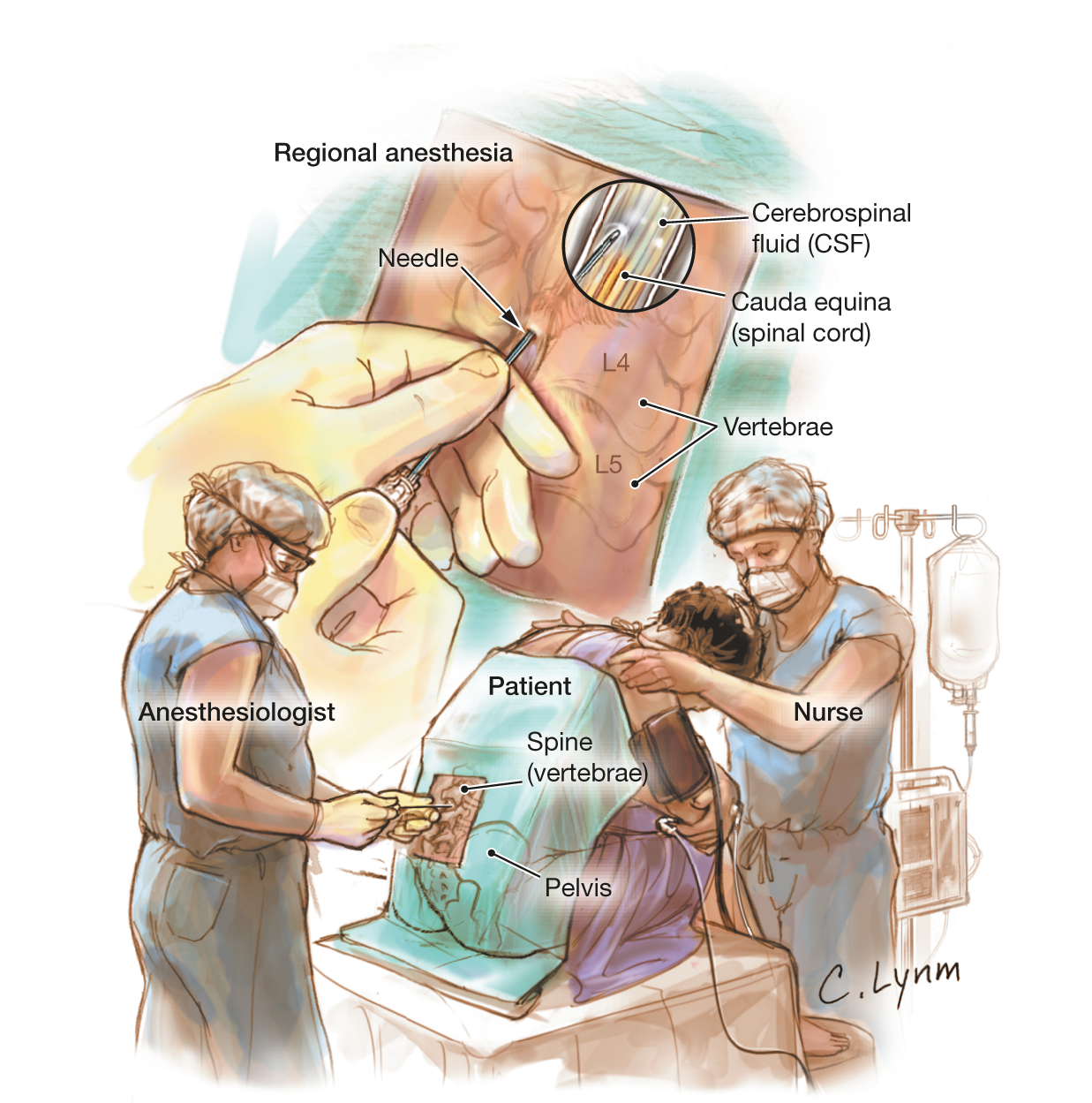 The Three Branches Of Anesthesia Bca Chemistry