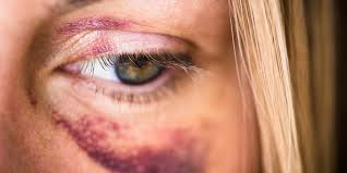Image result for domestic violence