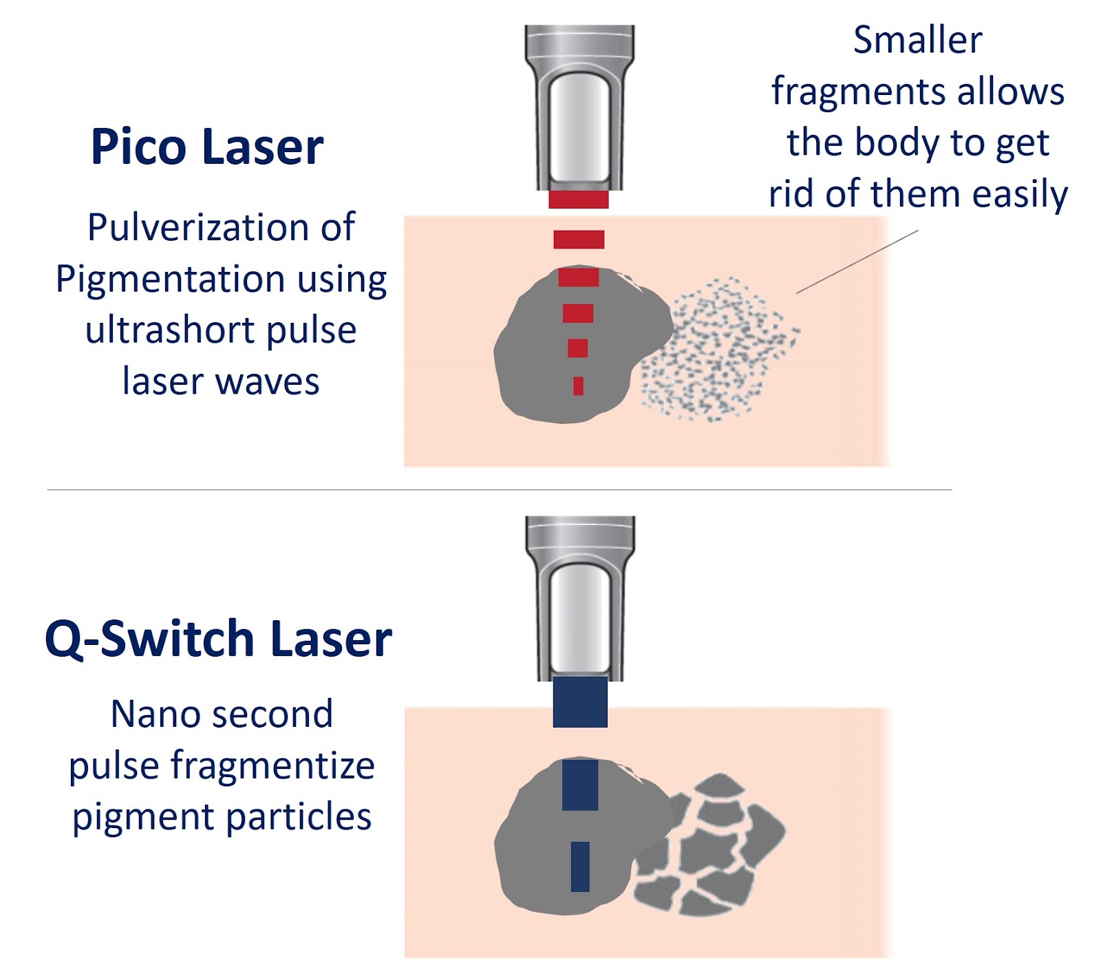 Pico laser 