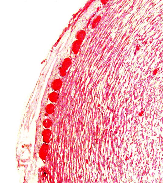 Surface of one umbilical artery with conspicuous small vessels; some lumens can also be seen in the muscular wall