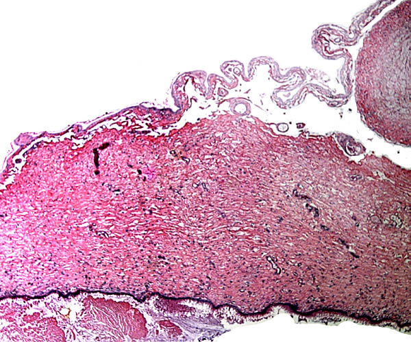 Microscopy of 'cervical star' in Przewalski's horse