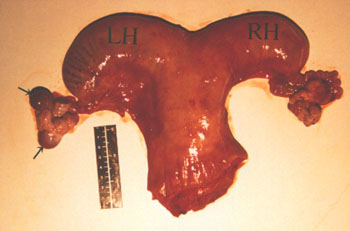 Non-pregnant camel uterus. Note that the left horn (LH) is longer than the right (RH) and there are two corpora lutea (arrows) on the left ovary.