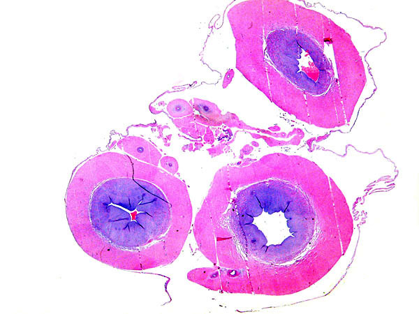 A cross section of the cord shows three large blood vessels and numerous smaller muscular allantoic vessels. In the very center are the possible epithelial vitelline remnants