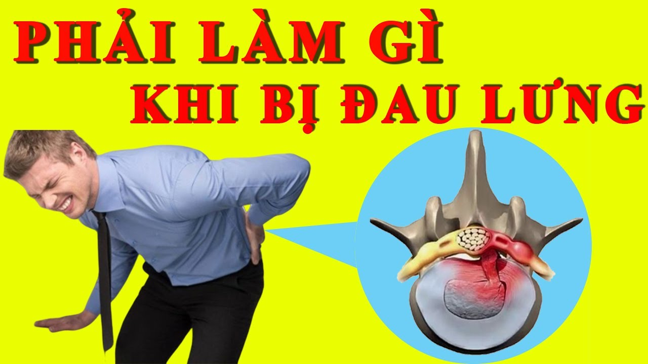 Phải làm gì khi bị đau lưng