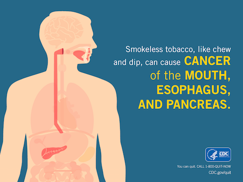 Smokeless Tobacco: Health Effects | CDC