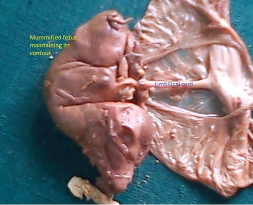 A mummified fetus recovered manually from the vagina of a buffalo. (Photo courtesy Dr Sanjay Purohit, Editor, Ruminant Science, Mathura, UP, India).