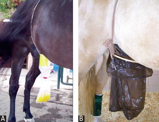 A plastic gallon jug, a collection bag taped to its spout, and straps attached to its base (A) or an embroidery loop with a bag attached (B)