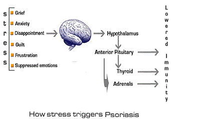 Stress Triggers Psoriasis
