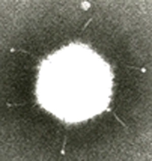 Aumento de una partícula de adenovirus teñida por contraste .