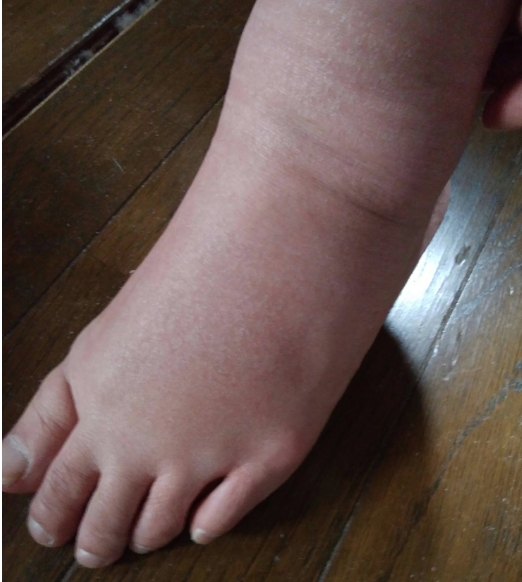 立ち仕事 むくみ解消 ポジティブにタスク管理
