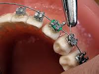 Image result for orthodontist