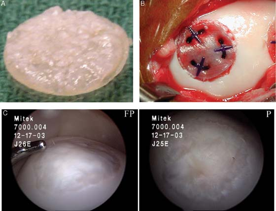 Construct of morselized cartilage before (A) and after (B) implantation and evaluation at 12 mo. Courtesy of Frisbie et al [262]. 