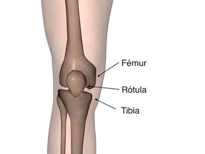 fractura rotula art