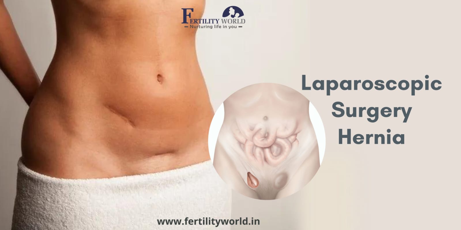 Detailed laparoscopic surgery hernia costs