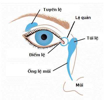 tắc tuyến lệ