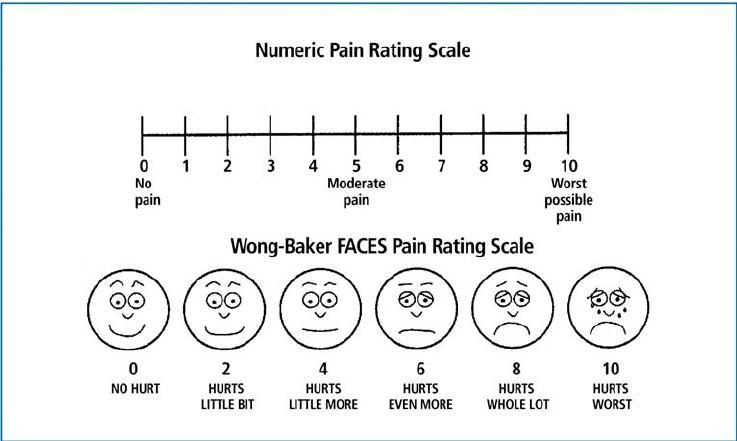 Wong-Baker Faces Pain Rating scale. 