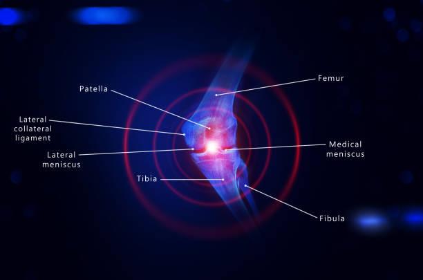 knee labeled diagram
