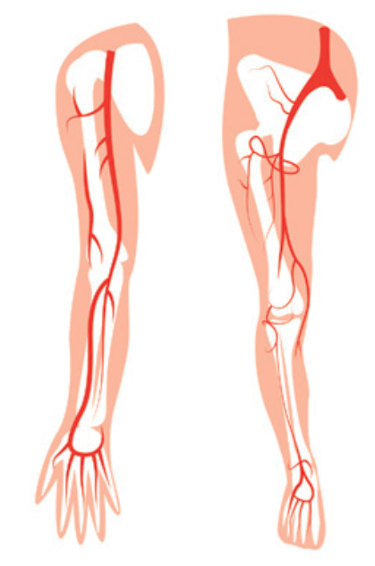 via intraarterial