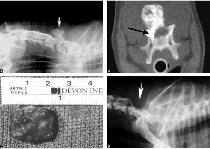 Extradural compression: Low-grade osteosarcoma of the lamina and pedicles of C6 in a 6-year-old, FS Yorkshire terrier
