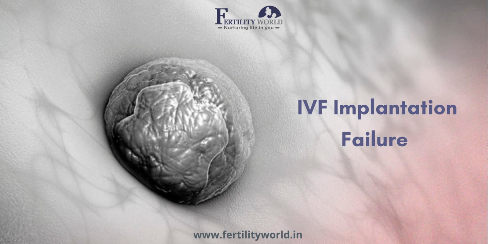 What are the reasons for IVF implantation failure?