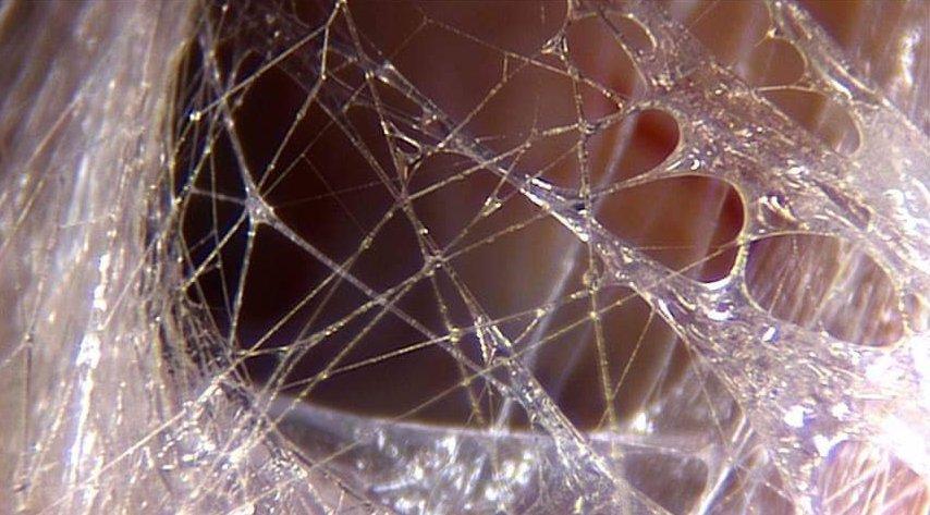 A Brief Introduction to Fascia: Structure, Function & Importance - Invictus  Fitness