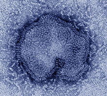 Transmission electron micrograph of H7N9 virus.