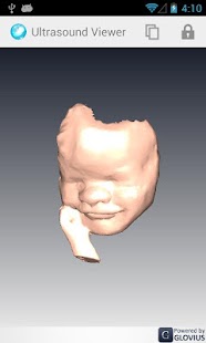 Download Ultrasound Viewer apk