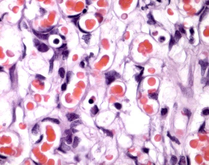 Higher magnification of the labyrinth with larger trophoblastic cells.