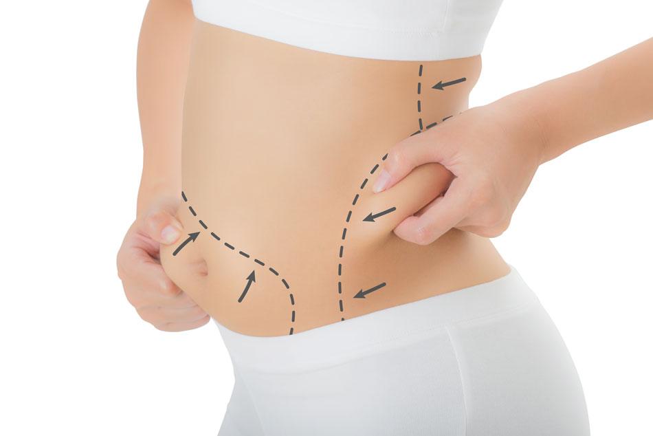 How Much Pain Will I Have After A Tummy Tuck?