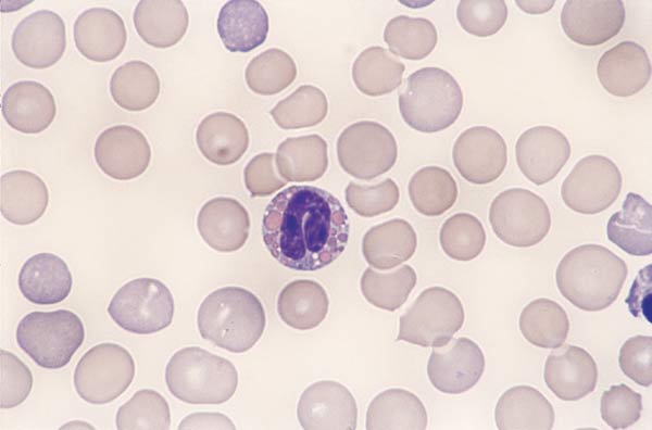 Canine eosinophils. Granules in canine eosinophils are round and can vary in size and number. A few granules are present and size variation is more pronounced.