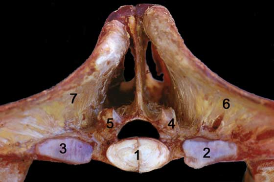Cranial aspect of the pelvic part of the lumbosacral junction showing the five articular surfaces of the sacrum.