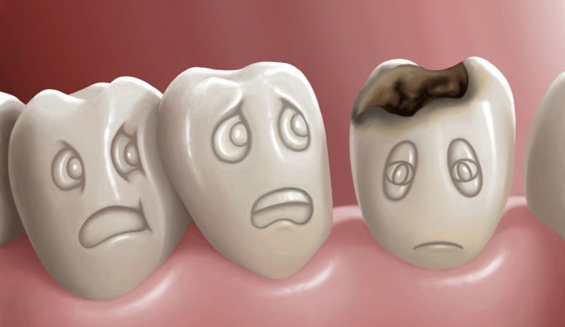 Nên đến bác sĩ để kiểm tra nếu đau nhức sau khi hàn răng một thời gian