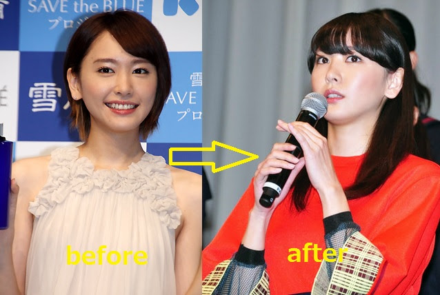 様々な画像 ロイヤリティフリー 妊娠 激 太り 芸能人